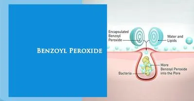 Benzoyl Peroxide là gì? Những thông tin về "khắc tinh" của mụn mà nàng nên biết