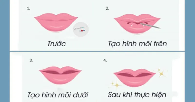 Các Biến Chứng Sau Phẫu Thuật Môi Bạn Cần Biết