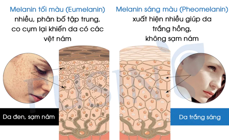 Cách làm giảm sắc tố Melanin giúp làn da trắng sáng hơn