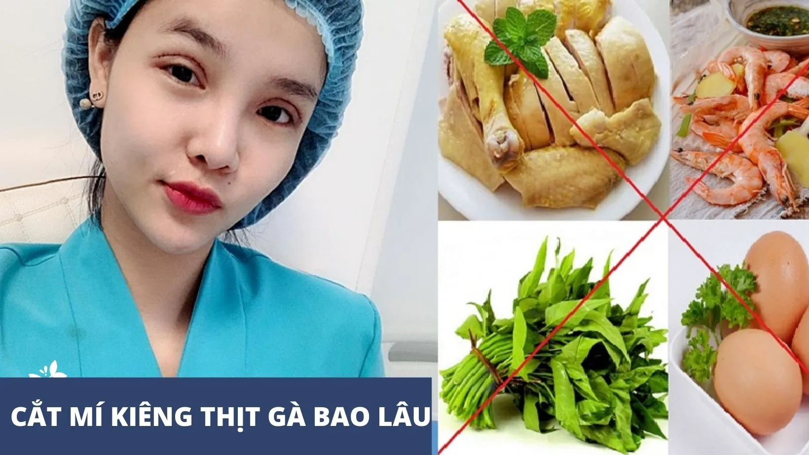 Cắt mí kiêng thịt gà bao lâu để mắt nhanh phục hồi?