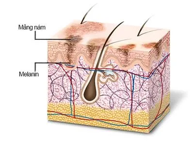 Giải mã bí kíp làm sáng da bằng thuốc làm giảm sắc tố melanin