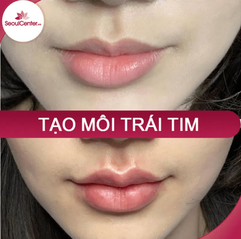 Gợi ý địa chỉ làm môi trái tim đẹp nhất Bình Dương, chi phí hợp lý