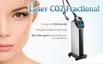 Hãy đọc ngay bài viết nếu bạn đang phân vân có nên xóa thâm mụn bằng laser