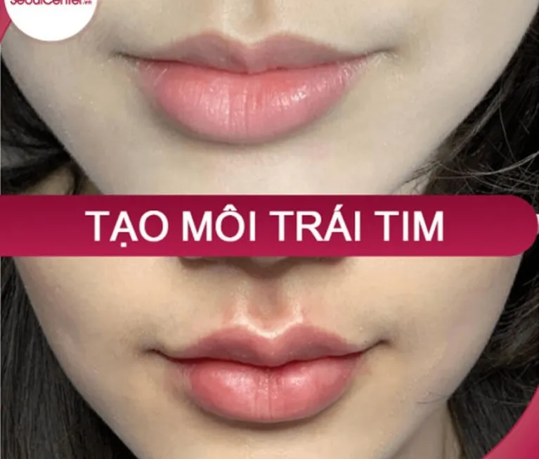 Làm môi trái tim ở đâu đẹp, an toàn, cơ sở hiện đại, uy tín