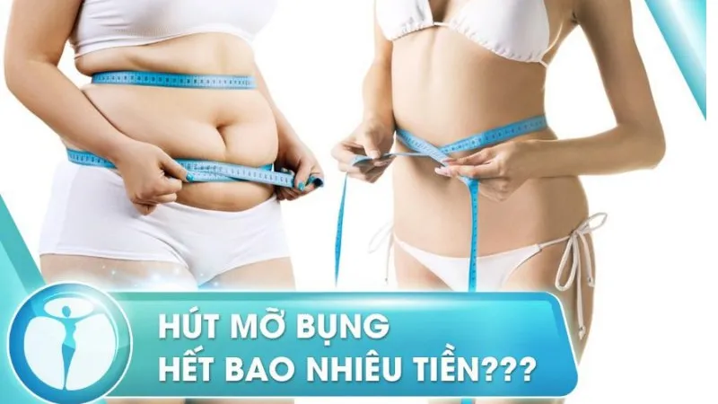 Liệu trình giảm béo bao nhiêu tiền thì hiệu quả