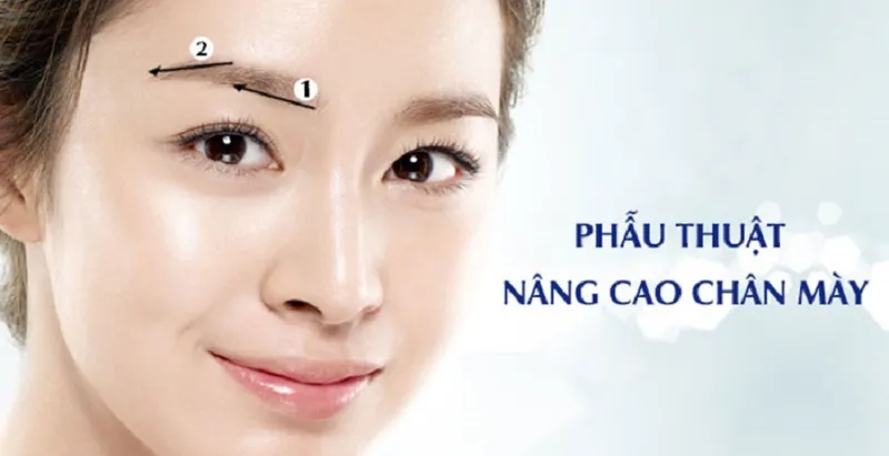 Nâng cung chân mày giá bao nhiêu? Địa điểm an toàn, uy tín