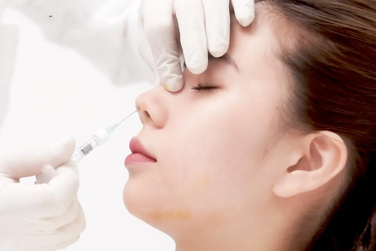 Những Điều Cần Biết Khi Tiến Hành Nâng Mũi Filler