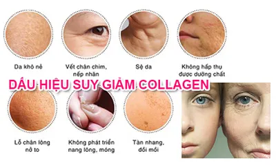 Níu giữ tuổi thanh xuân cùng các cách phục hồi làn da bị lão hóa sớm