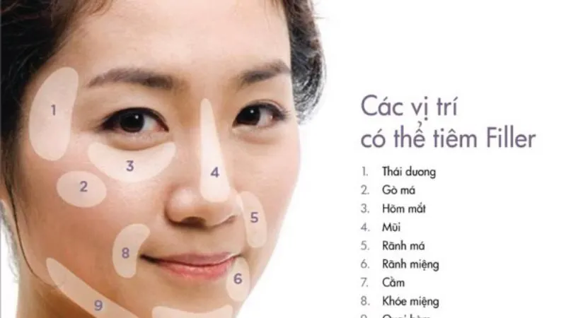 Tiêm filler cằm giá bao nhiêu tiền? Địa chỉ tiêm uy tín tphcm