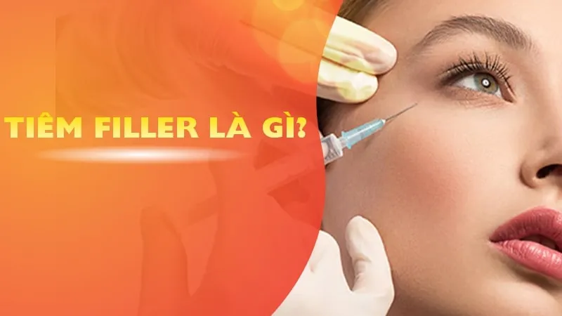 Tiêm Filler là gì? Tiêm Filler được bao lâu thì hết?