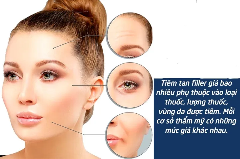 Tiêm tan filler giá bao nhiêu tiền? Tiêm ở đâu uy tín và an toàn?