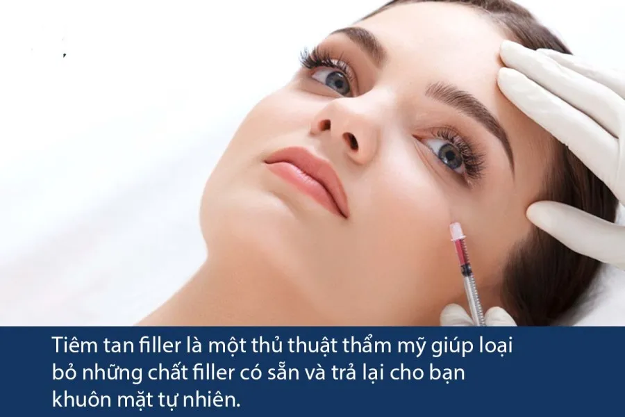 Tiêm tan filler giá bao nhiêu tiền? Tiêm ở đâu uy tín và an toàn?